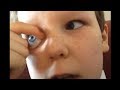 Bu Çocuk Gözlerini Dışarıya Çıkartabiliyor - Garip Şeyler Yapabilen İnanılmaz İnsanlar