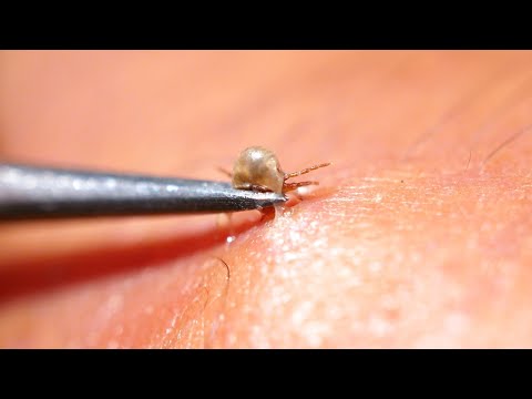 ウサギのダニ:寄生虫の侵入を予防し、治療する