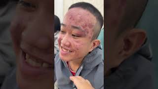 Not long ago, many people asked me what I was doing to this guy's face and I stayed silent