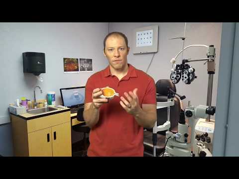 Seeing Weird Things in Your Vision? - Ophthalmic Migraines