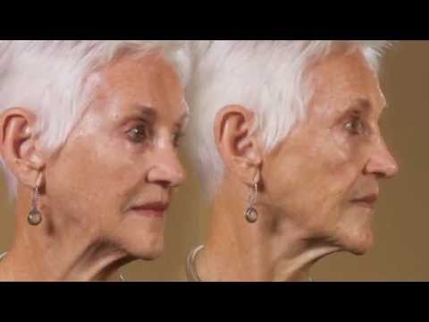 Sixty Second Facelift by dfi Aging