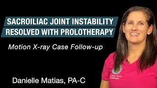 Sacroiliac joint instability improved after Prolotherapy- Motion x-ray case follow-up