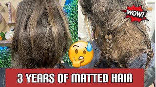 Extremely Matted ball on Caucasian hair.