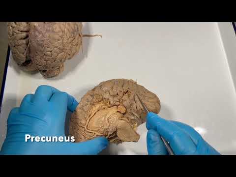 Medial surface of the cerebral hemisphere