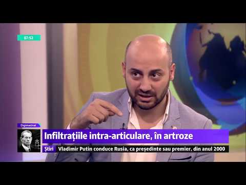 Artroza articulațiilor vertebrale costale cum se tratează