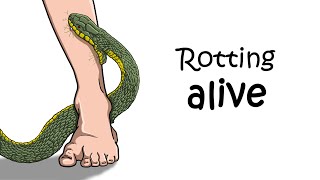 What It Feels Like to Die From a Snake Bite