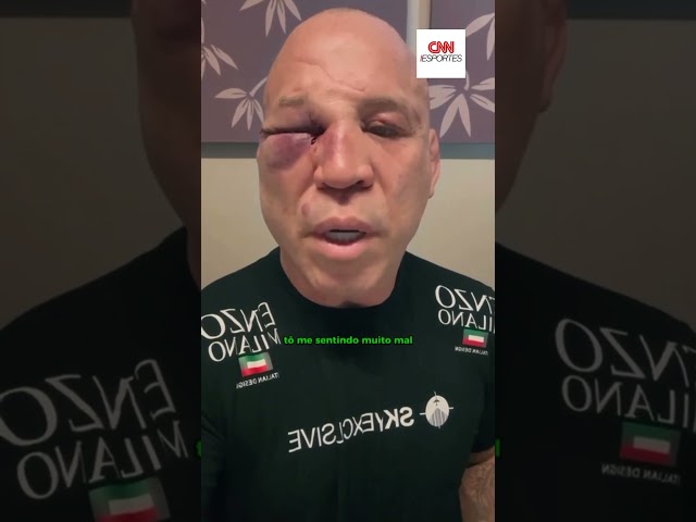 Wanderlei quebra o silêncio e acusa time de Popó de covardia em confusão | CNN ESPORTES