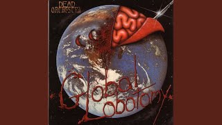 Global Lobotomy