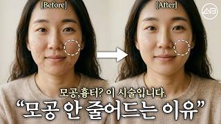 모공·흉터 고민? 이 시술이면 끝!