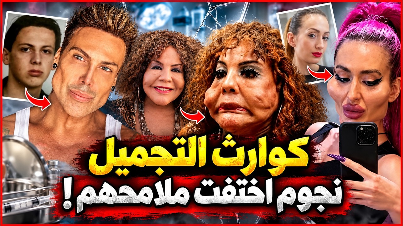 10 مشاهير قاموا بعمليات تجميل صادمة