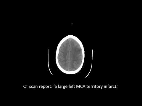 Donation after circulatory death