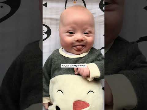 Love this little bean with all my heart 💛💙  #foryou #cutebaby #downsyndrome #downsyndromeawareness