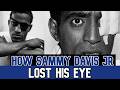 How Sammy Davis Jr. Lost His Eye – The Untold Triumph & Shocking True Story #sammydavisjr