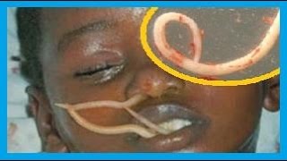 Que enfría la máscara para los ojos eyvon como usar