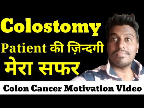 download lagu mp3 mp4 Colostomy Patients In India, download lagu Colostomy Patients In India gratis, unduh video klip Colostomy Patients In India
