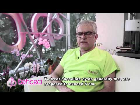 How endometriosis and chocolate cysts are treated? Do they require operations?