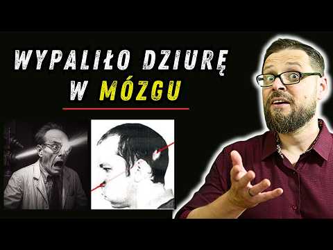 He stuck his head in a particle accelerator... So how did he survive? What didn't kill them episo...