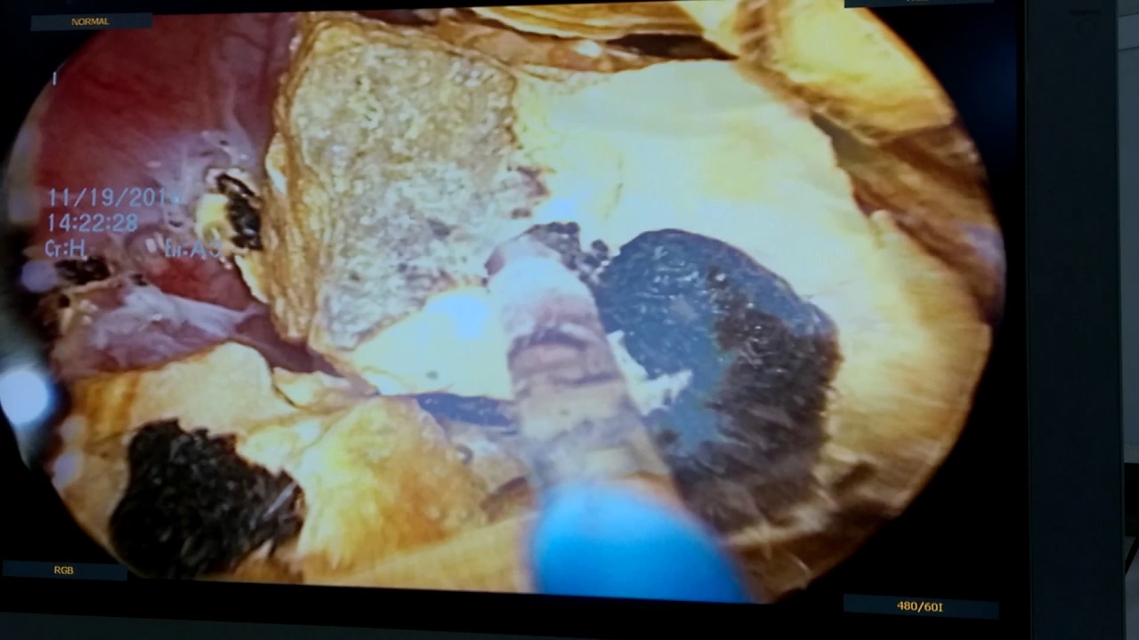 Andres Felipe Pérez Sanchez-1