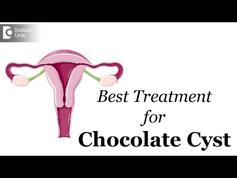 How are Chocolate cysts dealt? - Dr. Sunil Eshwar