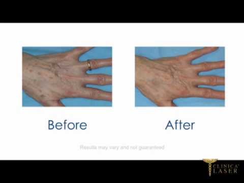 Il tè verde alla panna da pigmentary nota come usare La crema da pigmentary nota intorno a risposte di occhi