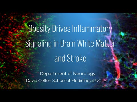Obesity Drives Inflammatory Signaling in Brain White Matter and Stroke