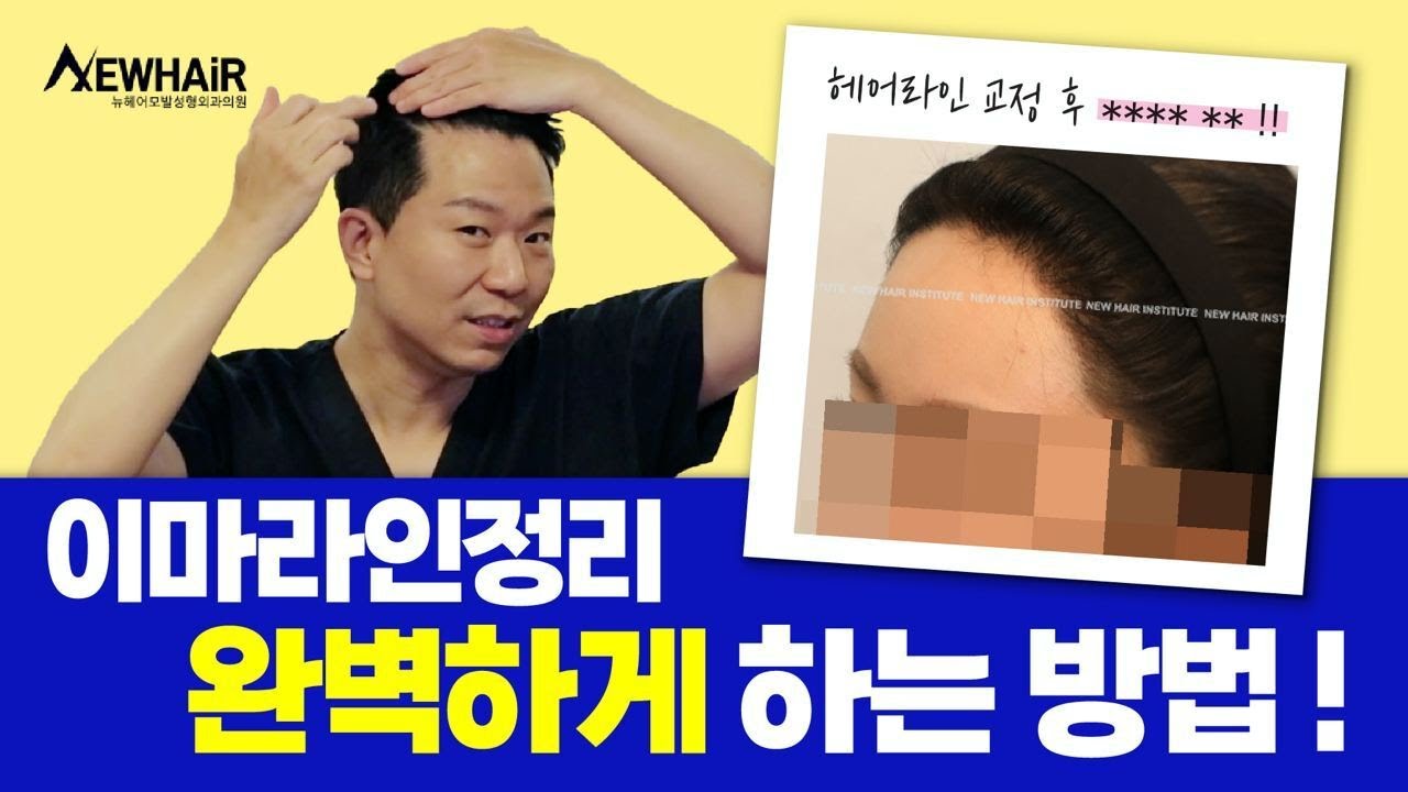 이마라인정리, 완벽하게 하는 방법!ㅣ뉴헤어