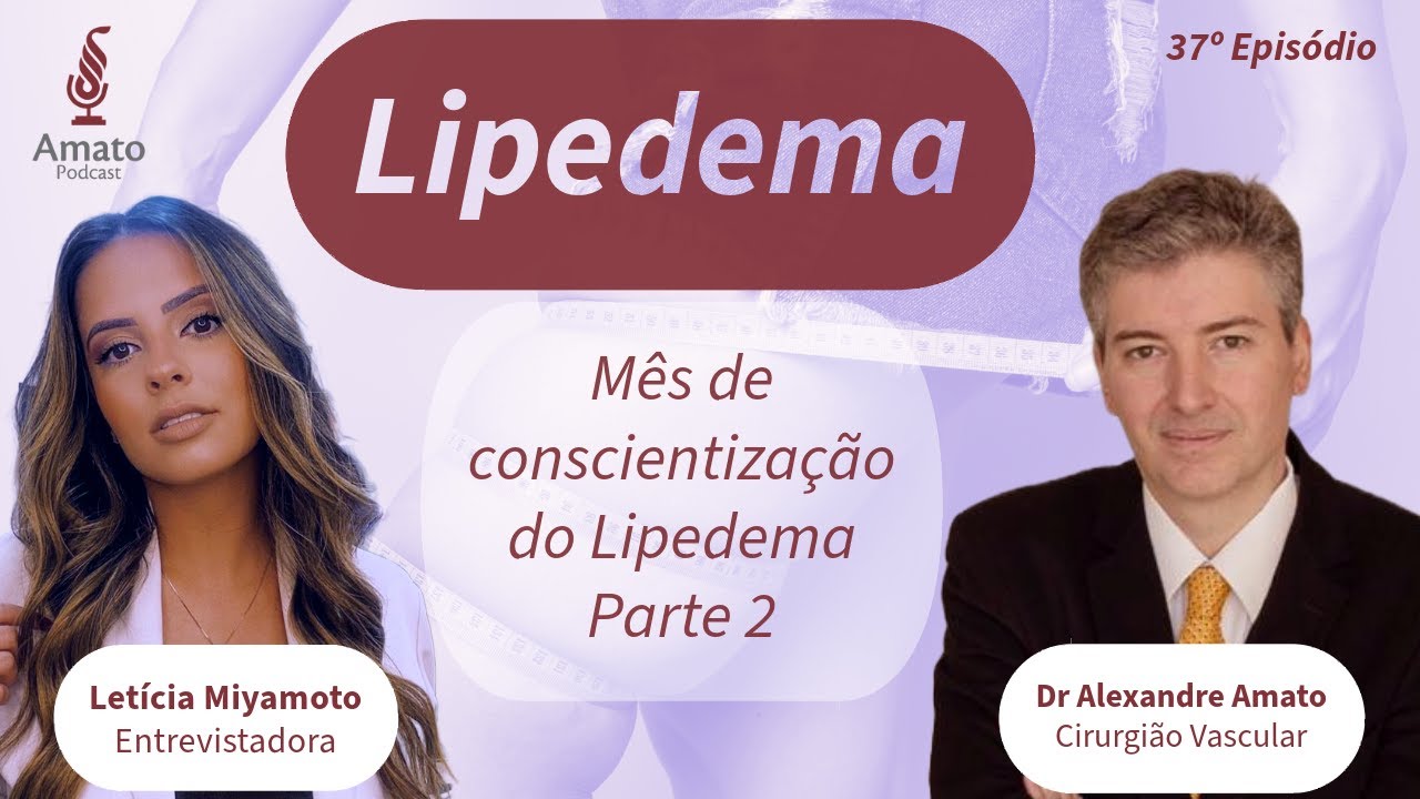 Lipedema: INFORMAÇÕES e Dicas Práticas: AmatoCast Ep 37 (Parte 2)