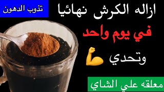 ضعيها على الشاي واشربيها ❗️وشوفي بنفسك إزاي الدهون بتنزل كتلة ورا كتلة بدون رجيم #طبيعي_وبس