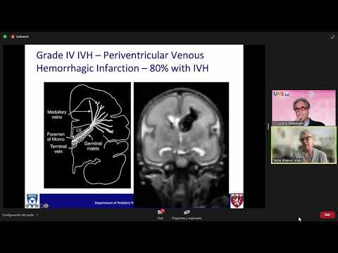 3 How does the brain of premature babies respond to IVH