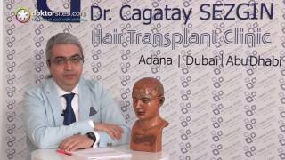 Doktorum saç ekim operasyonuna bizzat katılacak mı?