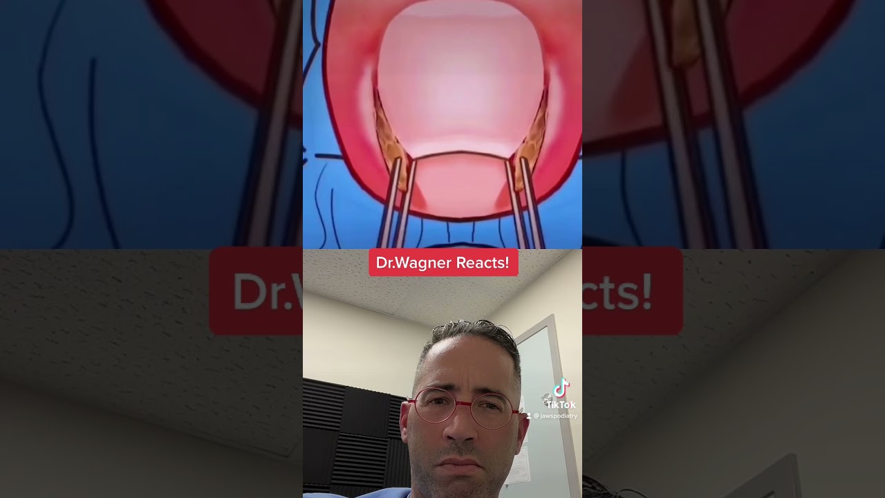 INGROWN TOENAIL ASMR😩#shorts #ingrowntoenail