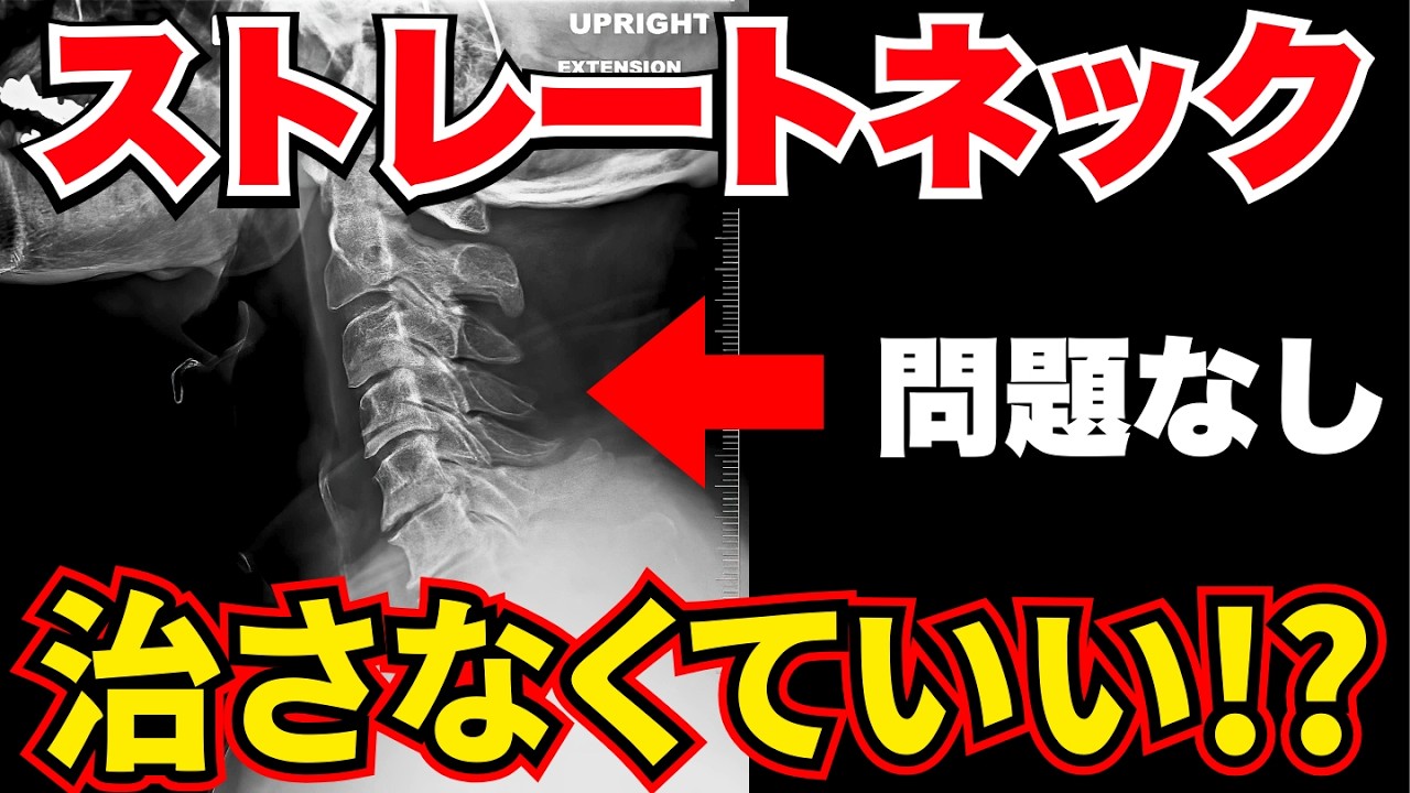 【9割が誤解】ストレートネックだから痛い？それ、真っ赤な嘘です。【最新論文で判明】