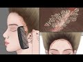 ASMR Animation Satisfying Scalp Treatment Big Flakes Dandruff Removal Meng S Stop Motion