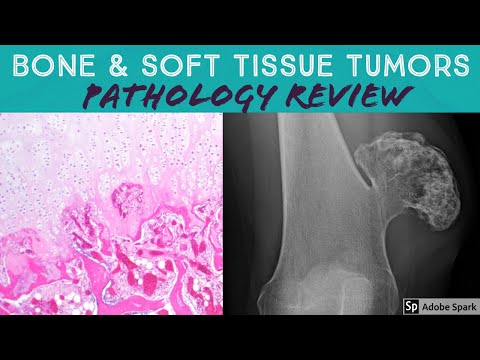 Bone & Soft Tissue Pathology Board Review (21 Classic Cases)