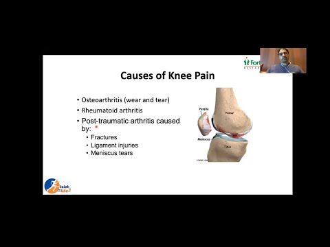 Myths and facts about knee arthritis and joint replacement | Dr. Subhash Jangid
