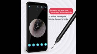 Smart Wireless Ear Otoscope