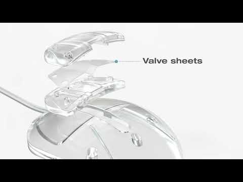Ahmed Glaucoma Valve Surgical Animation