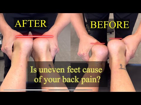 Fix short leg, reduce back pain