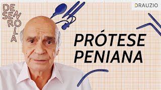 Como funciona a prótese peniana