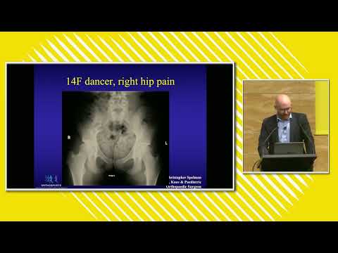 2023 01 Hip pain in children and adolescents - Dr Chris Spelman