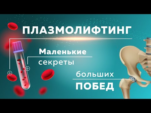 Плазмолифтинг суставов. Уколы в сустав или операция? Лечение болей в суставах без лекарств