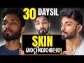 Clear ALL YOUR SKIN PROBLEMS in 30 DAYS. SCIENTIFIC GUIDE to remove PIMPLES, ACNE, BLACKHEAD at HOME