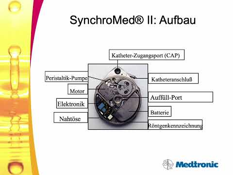 Dr. Georgios Matis - Neuromodulation - Auffüllung von implantierbaren Infusionssystemen (🇩🇪)