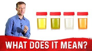 What Does The Color Of Urine Tell You About Your Body? – Dr.Berg