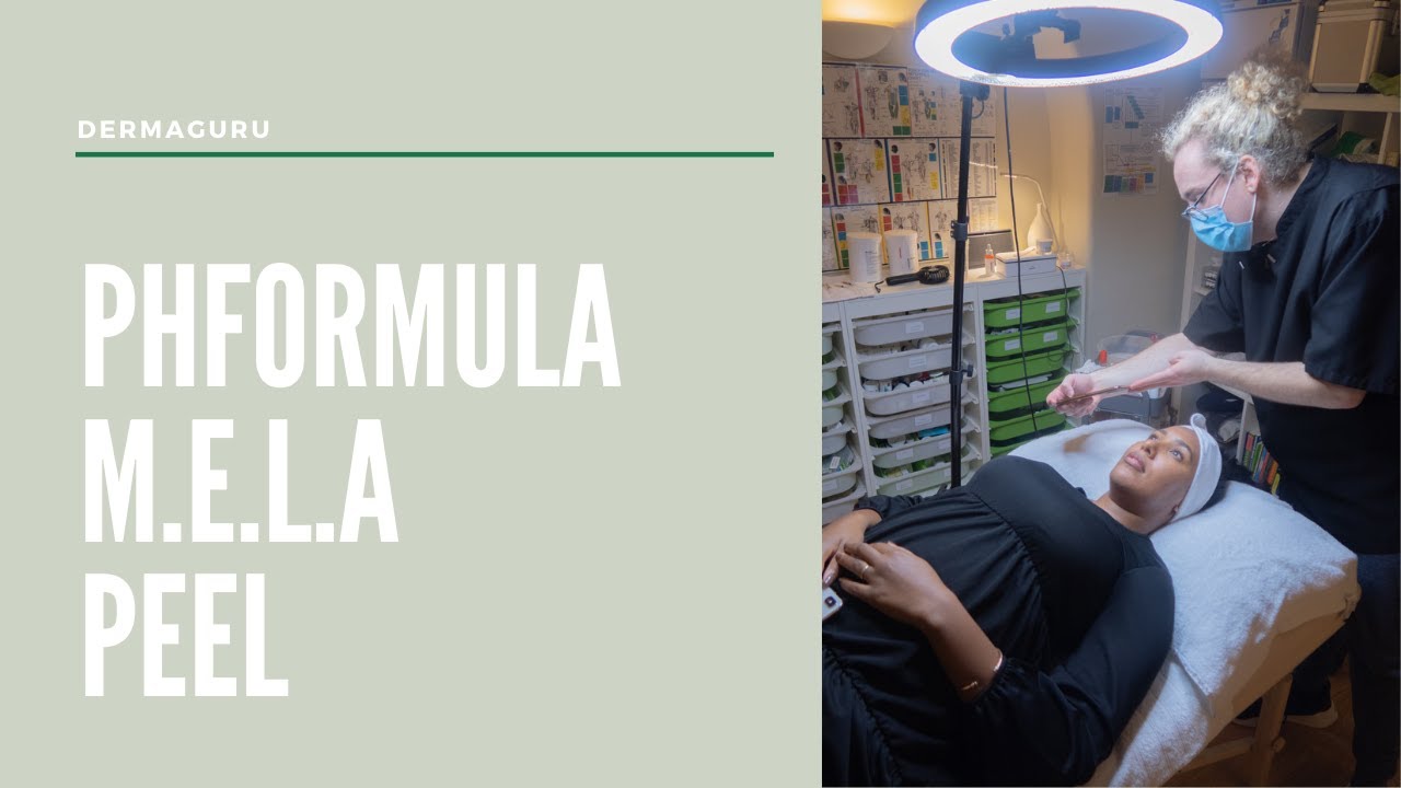 pHformula M.E.L.A Peel | Treatment For Black Skin, Dark Spots & Hyperpigmentation | Episode # 1