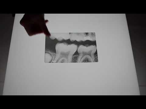 Dental X-Rays 