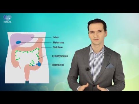 Behandlung von Prostatitis Rosskastanie in der Volksmedizin Verkalkungen in der Prostata