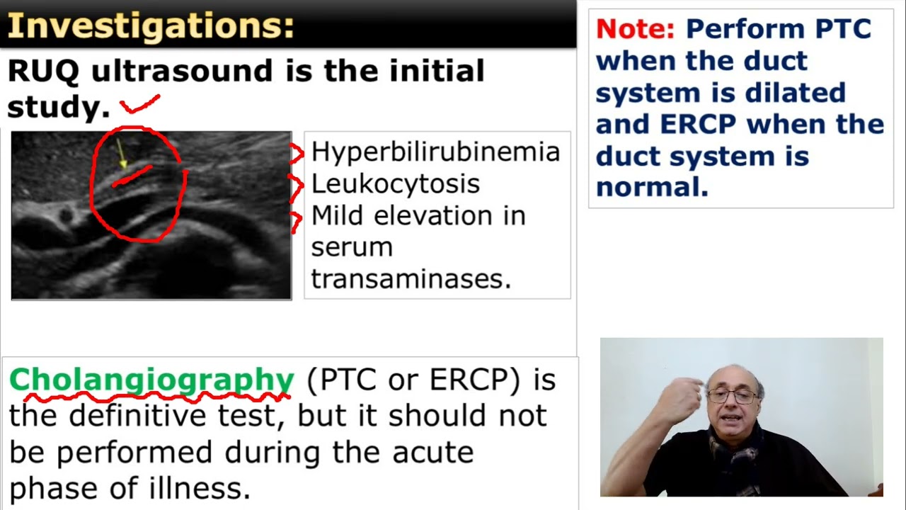 Ascending Cholangitis