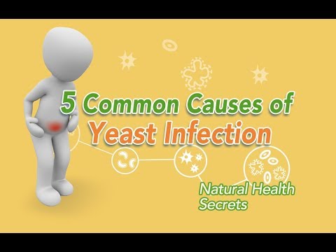 [Natural Health Secrets] Episode 38: 5 Common Causes of Yeast Infection