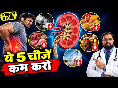 Kidney Stone Foods to Avoid | पथरी में ये 5 चीजें कम करें